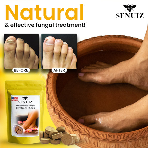 SENUIZ™ Bee Venom Nail Fungus Treatment Soak (10pcs) - 🔥Expert-Approved! Get Your Special Offers While They Last!