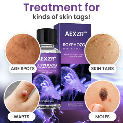 AEXZR™ Scyphozoa Skin Tags Solution - 🔥 Top Dermatologist Picks! Save Big with Limited-Time Deals! 💸