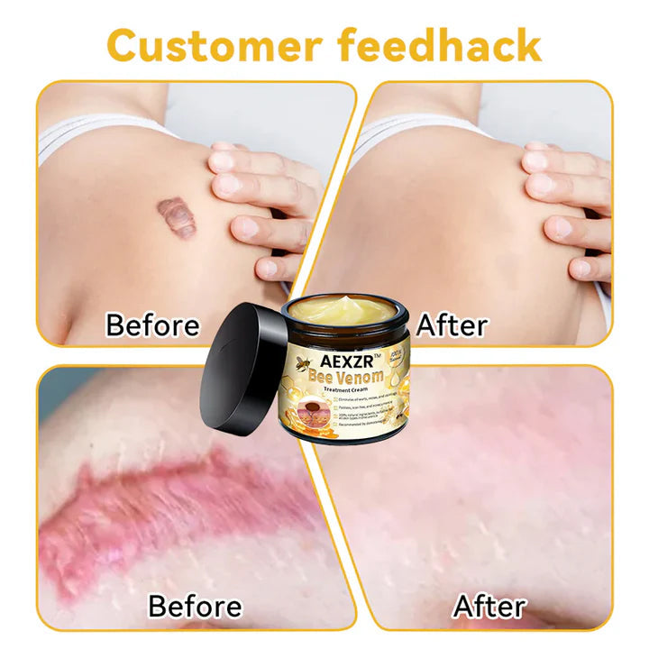 AEXZR™ Bee Venom Skin Treatment Cream - 🔥Recommended by Experts in Skin Care!👩‍⚕️