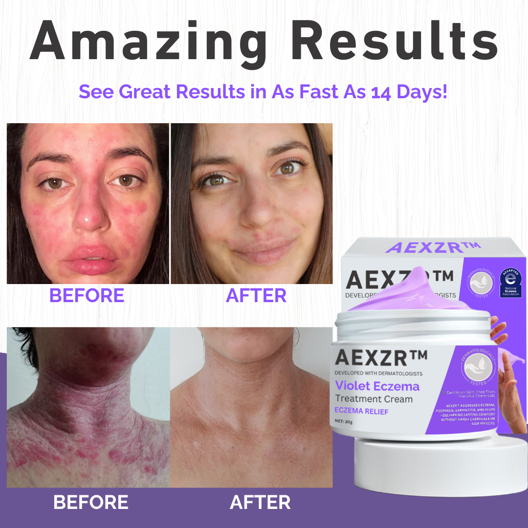 AEXZR™ Violet Eczema Treatment Cream - 👩‍⚕️ Recommended by board-certified dermatologist!