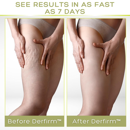 Derfirm™ Collagen Firming Body Cream - 👩‍⚕️ Recommended by Dermatologist! 🔥 Grab Your Limited Discounts Today! 💰