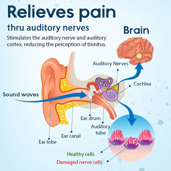 HearEase™ Tinnitus Relief Treatment Ear Patch - 👨‍⚕️Recommended by Expert!